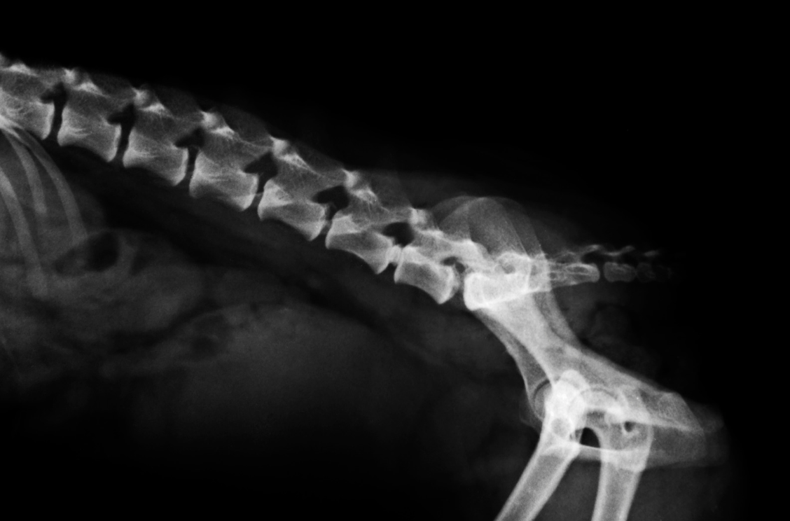 Schéma anatomique d'un foramen intervertébral au niveau de la colonne lombaire